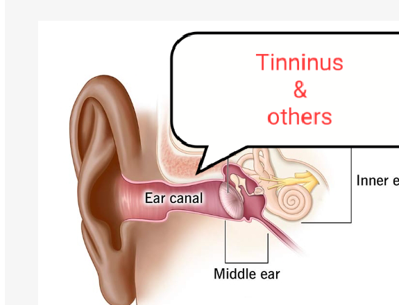 Image of tinnitus treating by herbs